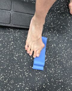 bunion treatment