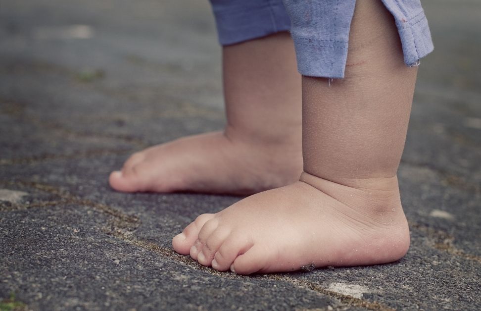 Flat Feet in Children Singapore: When To Worry (Holland Grove angle)